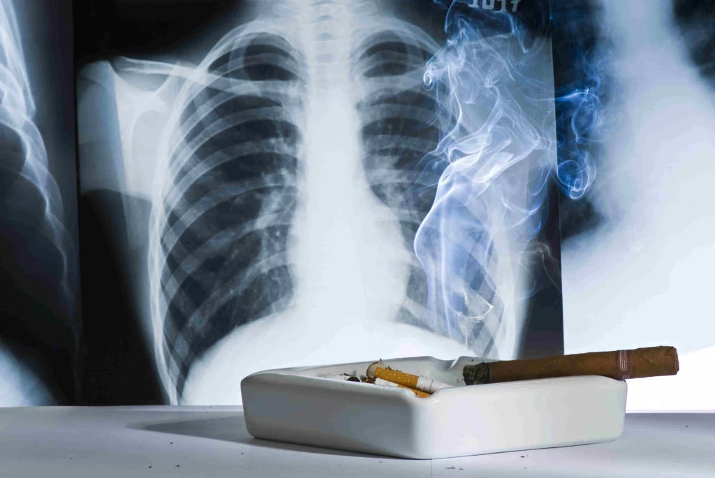 Tabaco y cáncer de pulmón: una relación mortal que sigue vigente